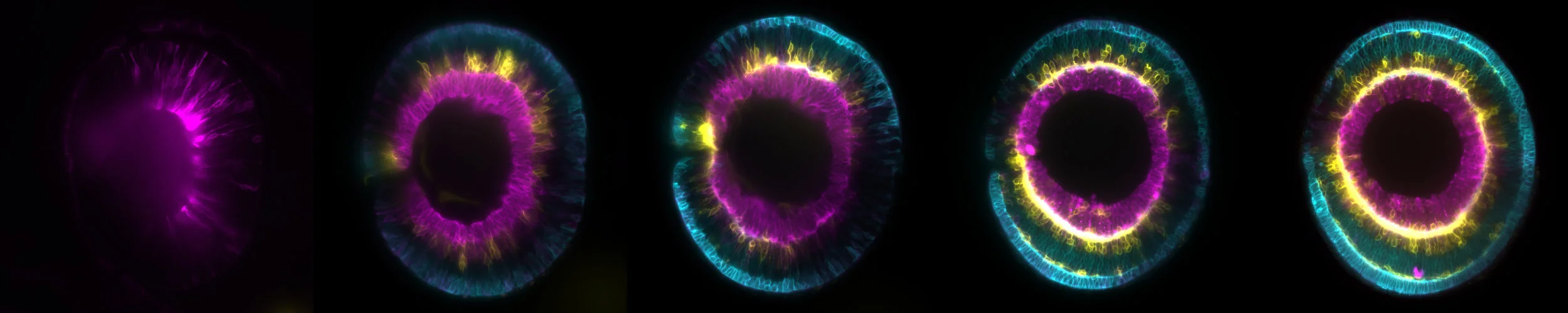 Watching you... The development of a single zebrafish retina, by Icha Jaroslav , Wikimedia.