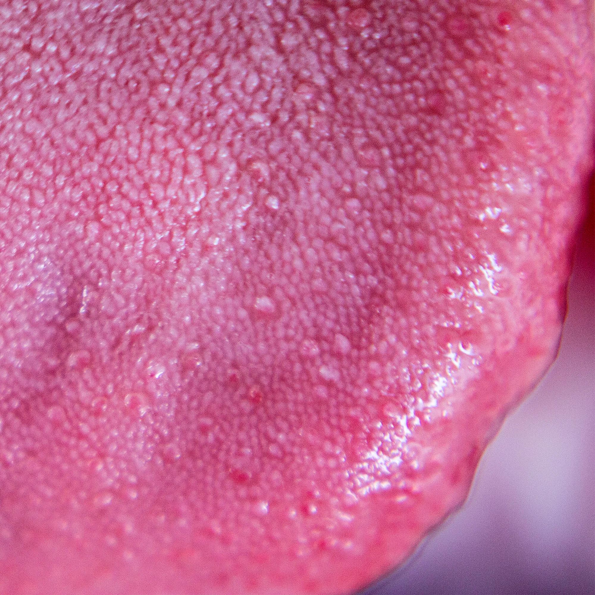 tongue.jpg