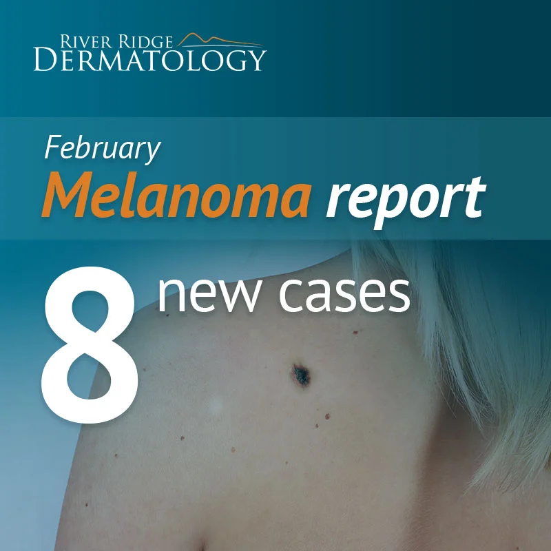 RR_melanoma_image_FEB_170314.jpeg