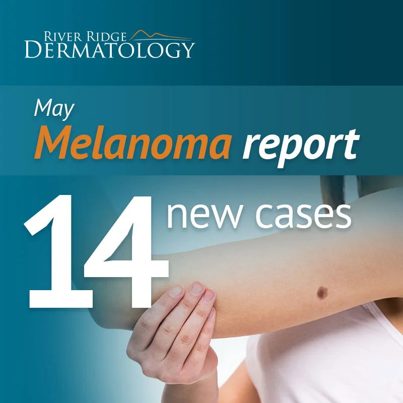 RR_melanoma_image_MAY_170622_UPLOAD.jpeg