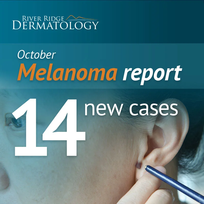 RR_melanoma_image_OCT_171208_dr1b.jpg
