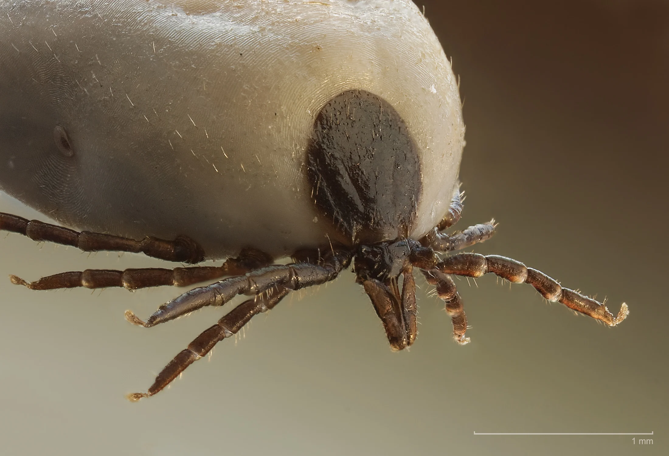 PANS/PANDAS And Lyme Disease