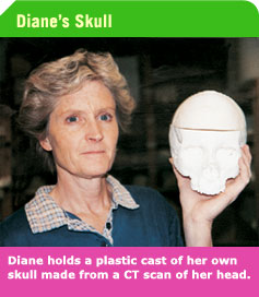 Diane_holds_plastic_cast_of_her_head.jpg