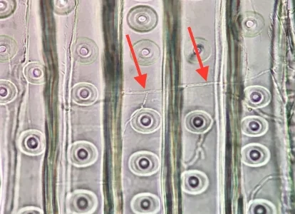 This set of two images are actual photomicrographs taken at Wood Science Consulting showing wood decay hyphae in wood cells similar to the sketch above. 