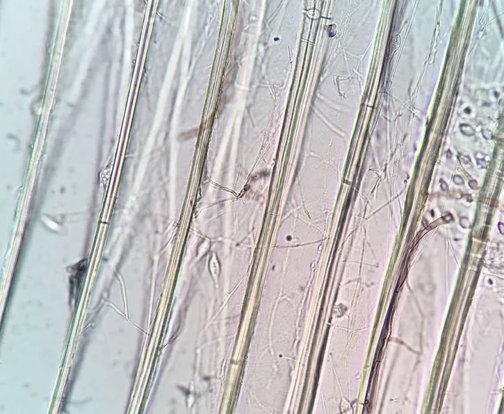 Wood Decay and Strength Loss