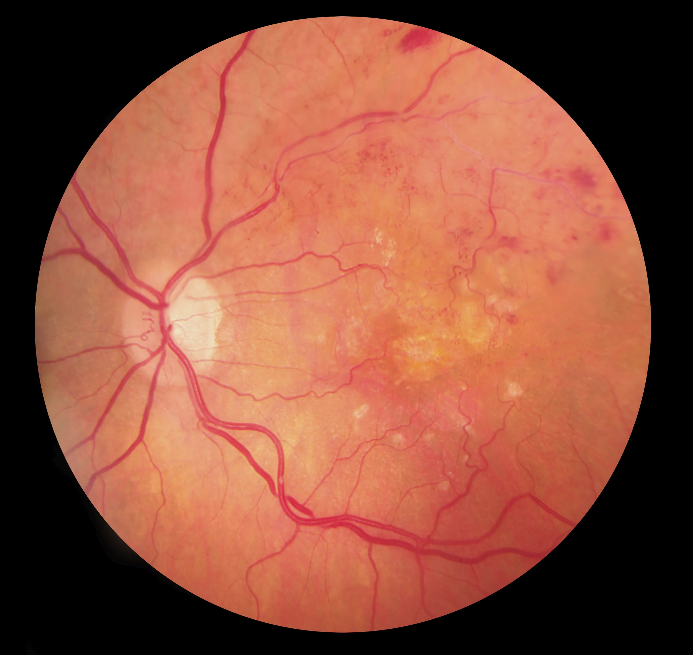 retina.jpg