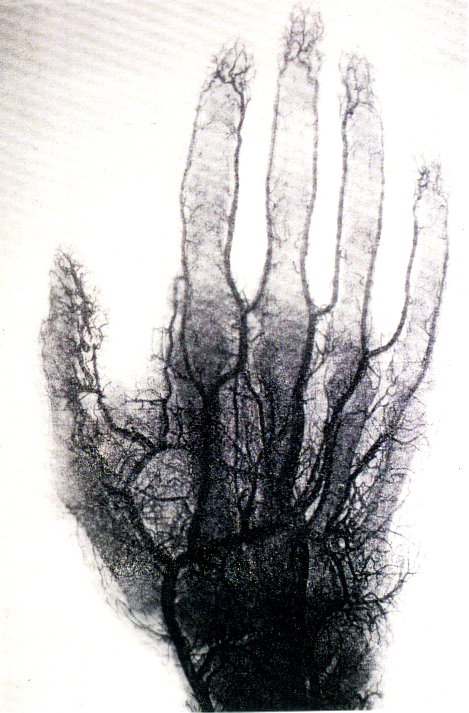 x-ray blood vessels copy.jpg