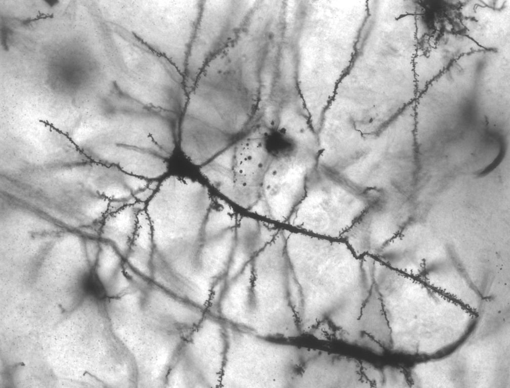 1008px-pyramidal_hippocampal_neuron_40x.jpg