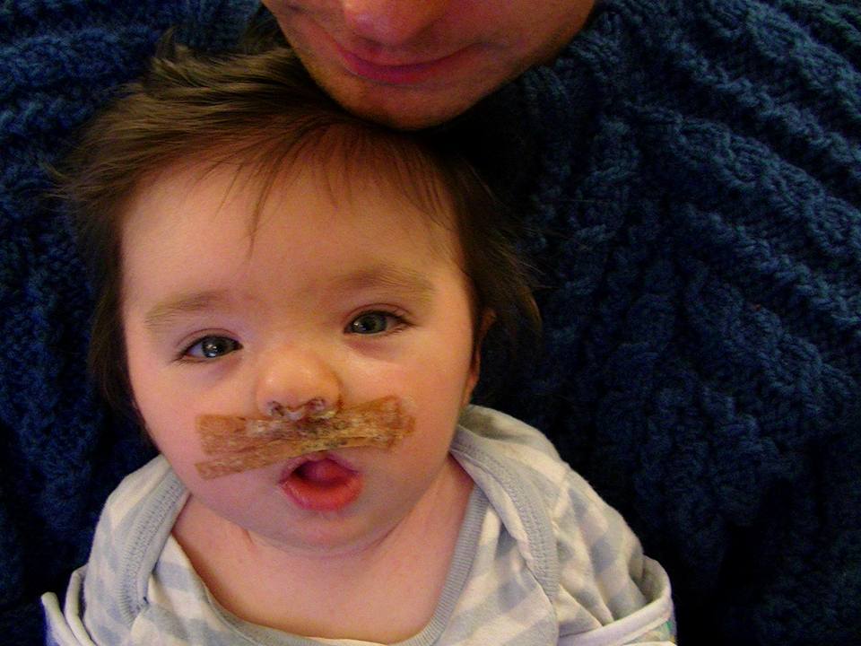 After Kaeden's surgery: Image provided by family