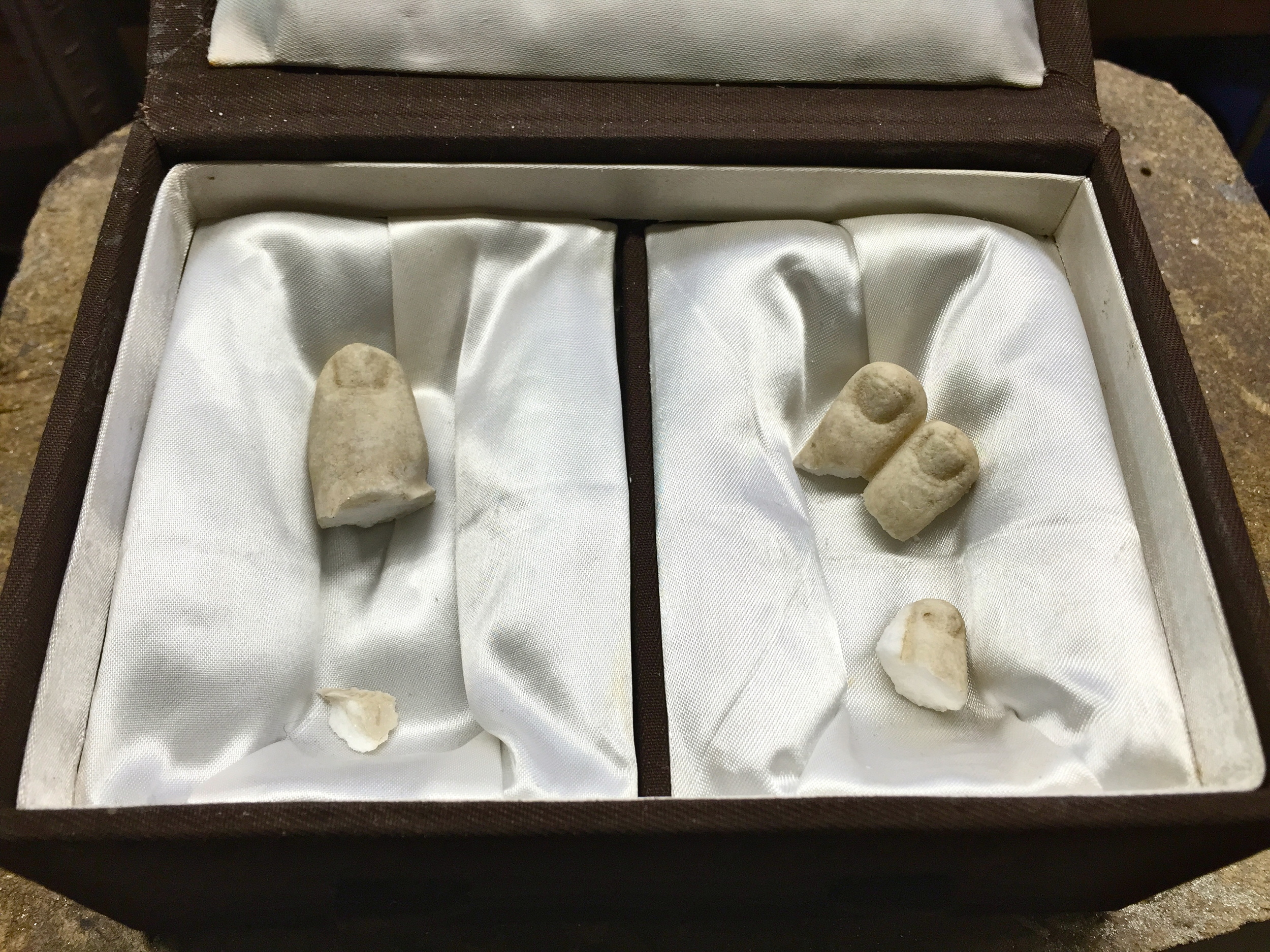 Remarkable how unnerving it was to find these toes in the box