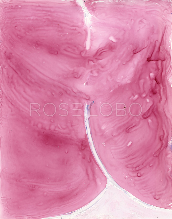 PINK BOTTOM