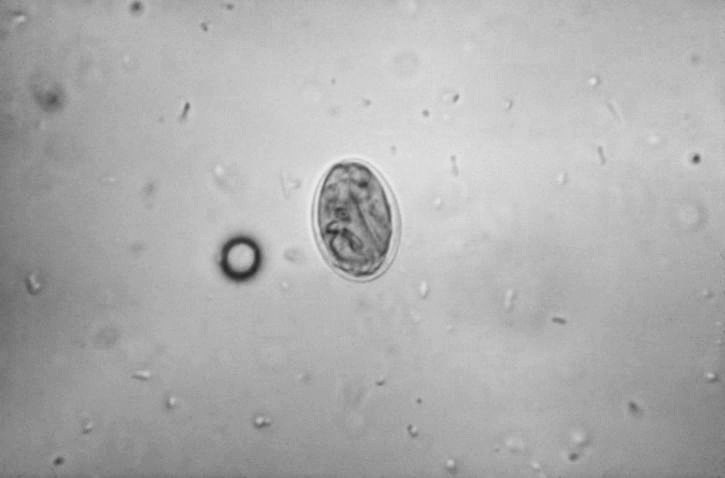 Giardia Cyst