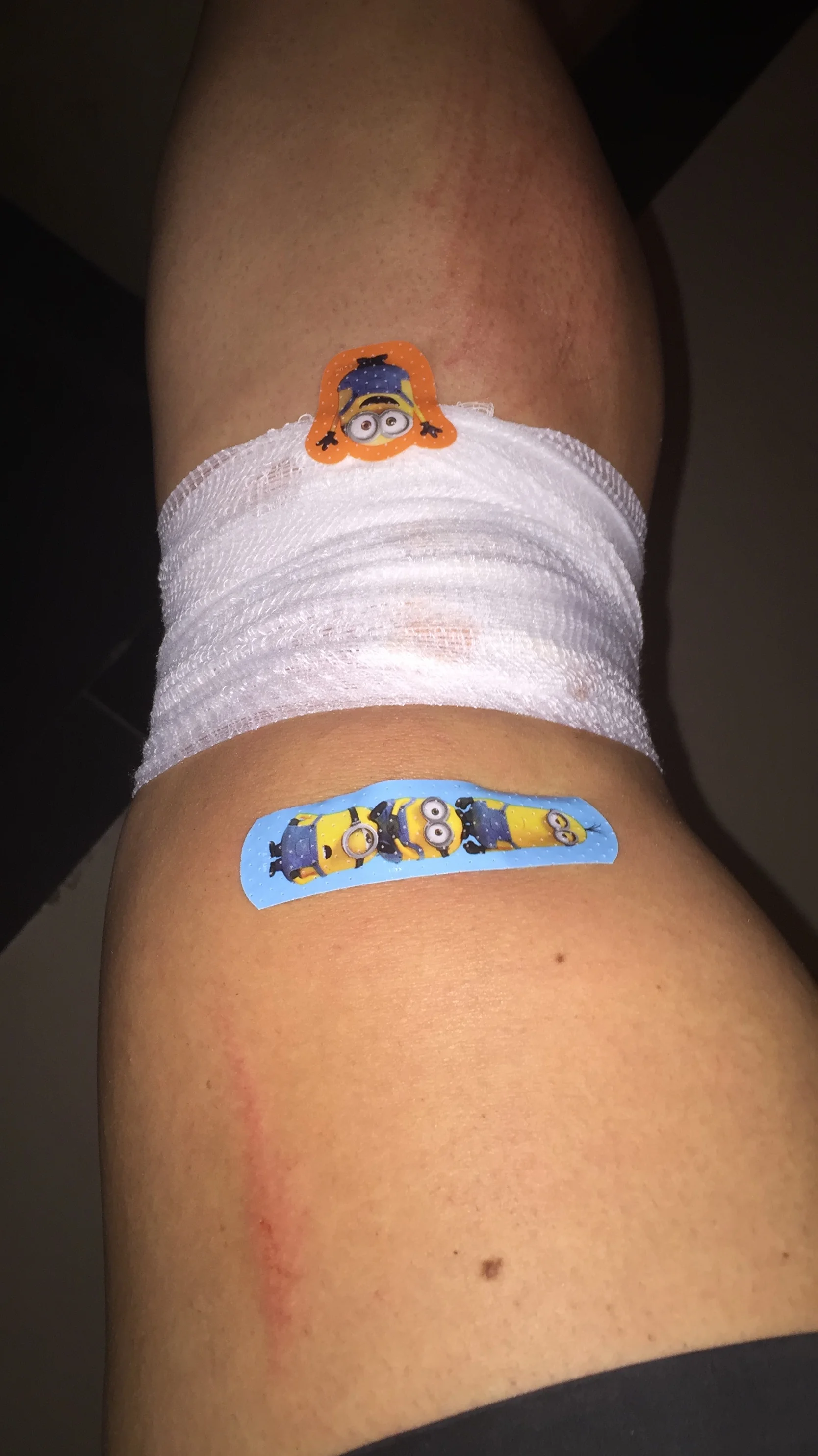 My Knee