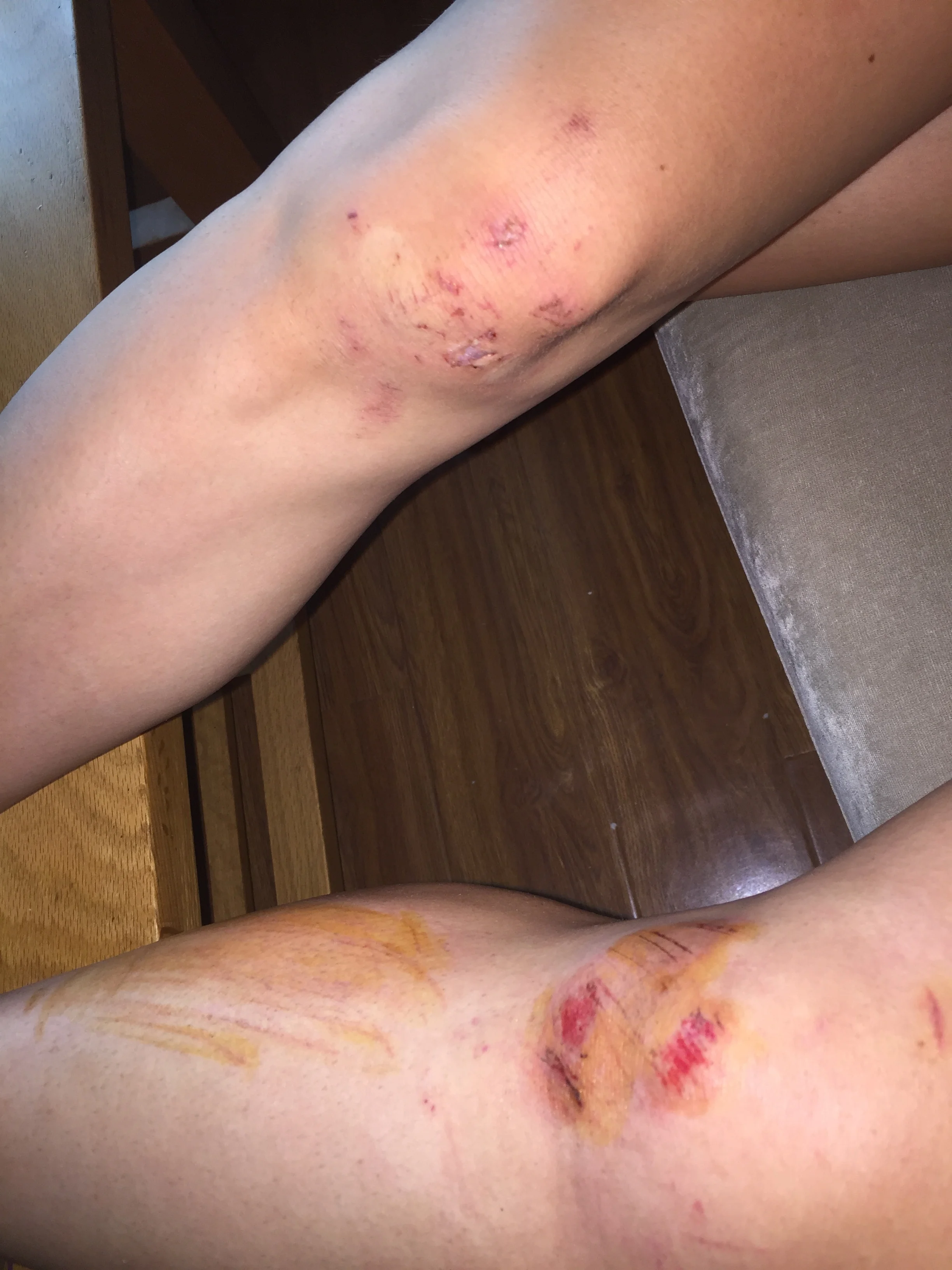 Our Knees