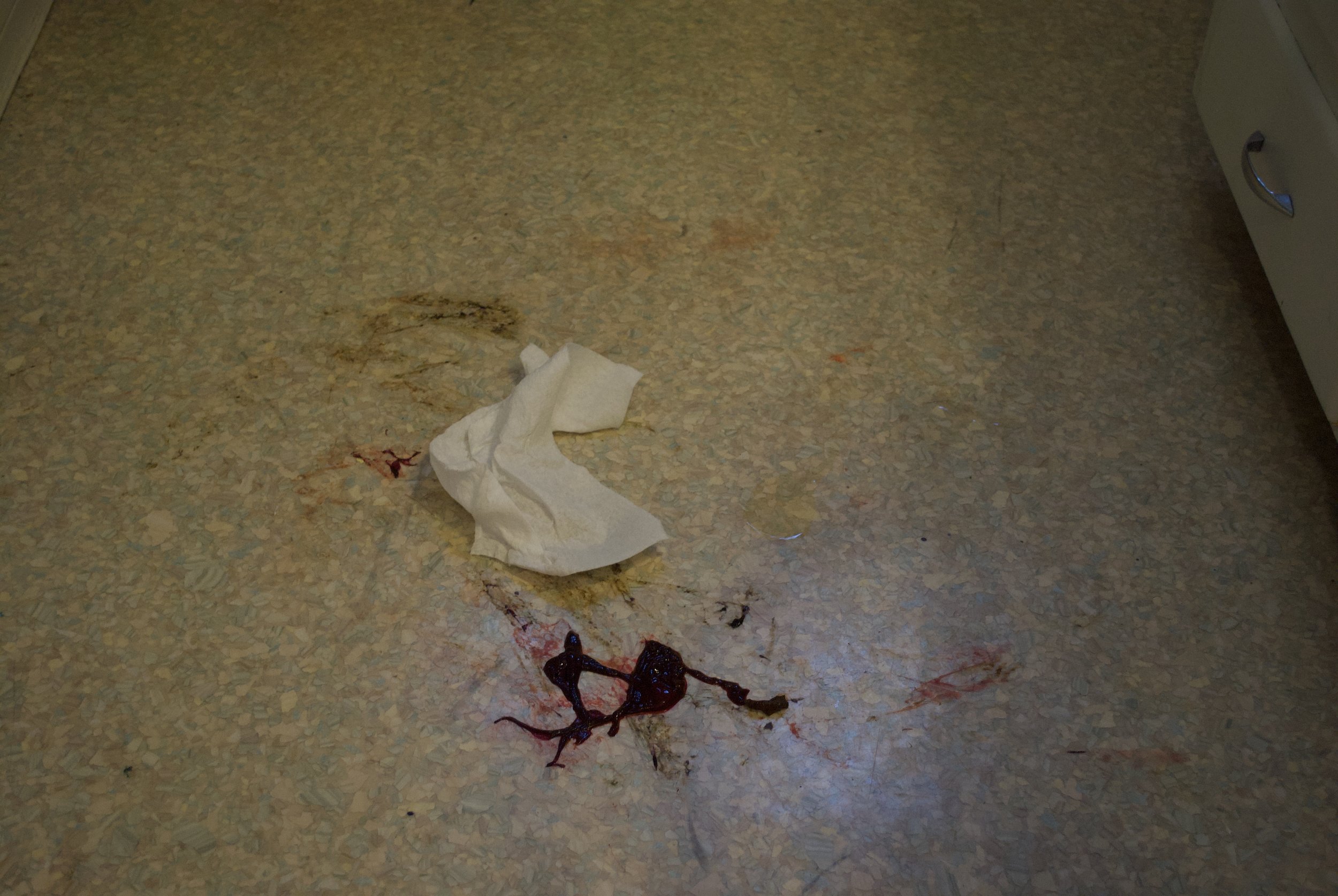 Here’s some dried blood and clots from my insides that didn’t make it onto towels. It’s not that bad!