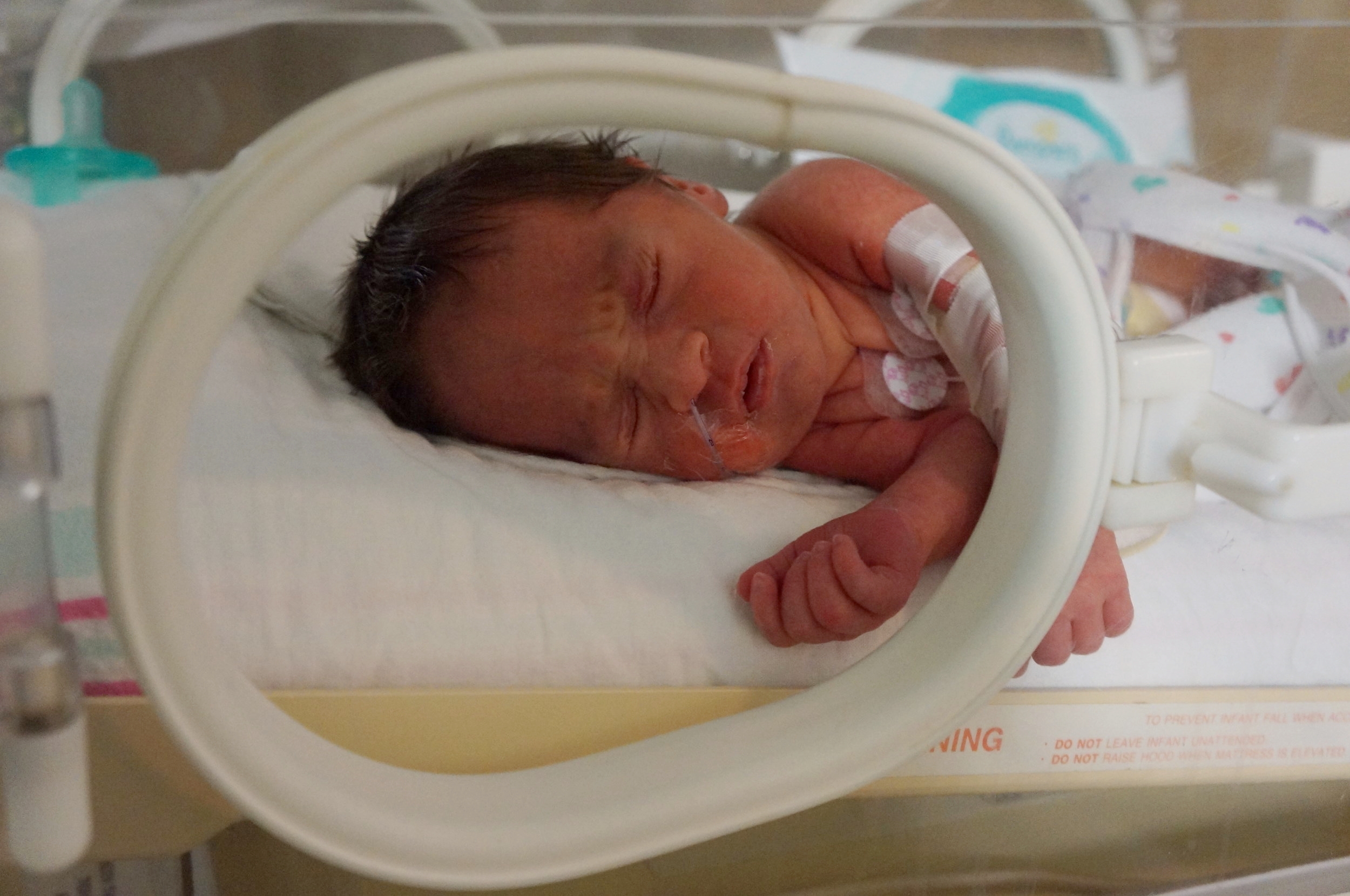One of Beau's many days in the isolette. At this point, he still had an IV, feeding tube, leads and temperature control.