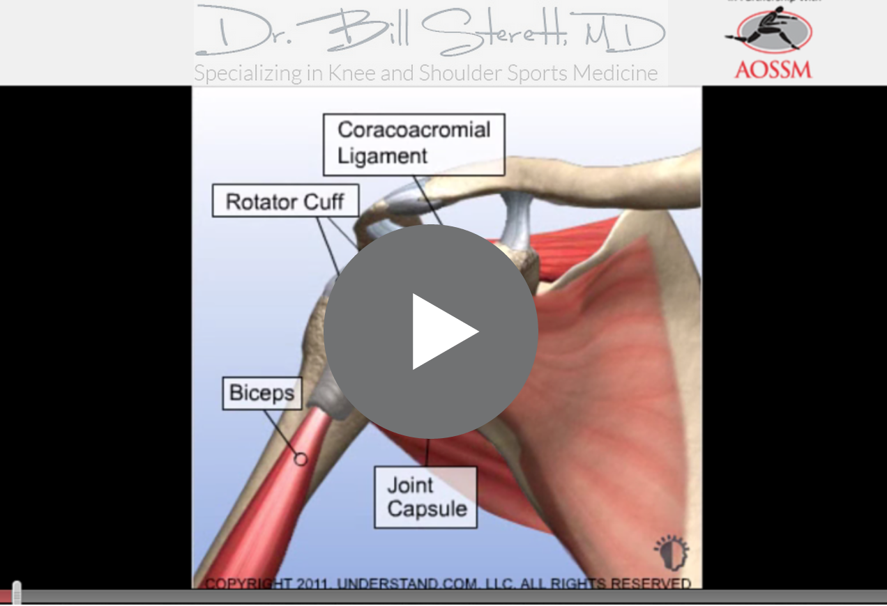 Rotator Cuff Tears & Surgery Questions & Answers — THE SPORTS MEDICINE