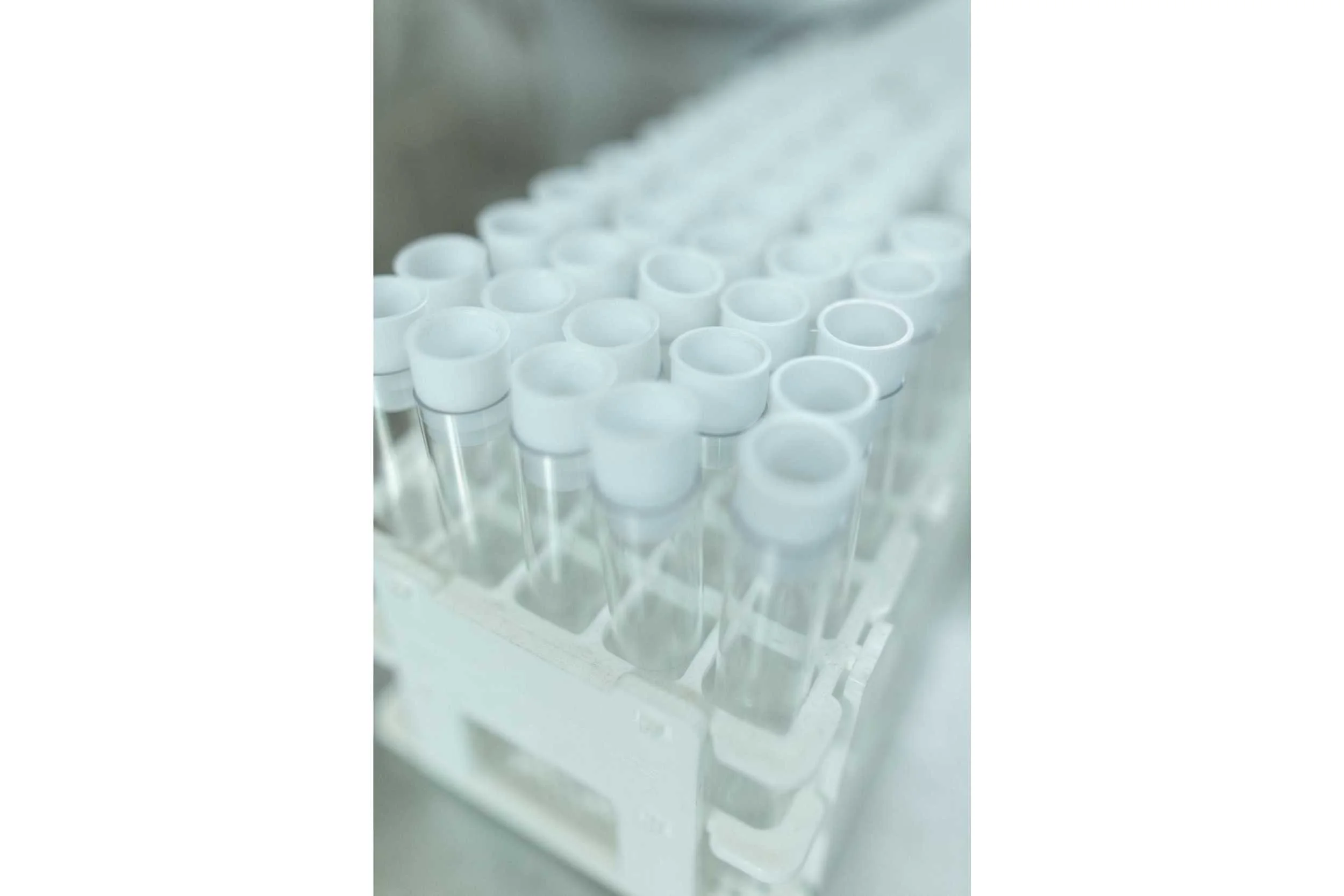 Lab vials in tray with slots