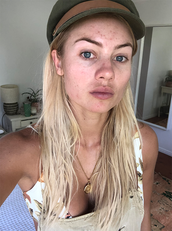 Elyse Knowles Skin Update May 2019 0.png