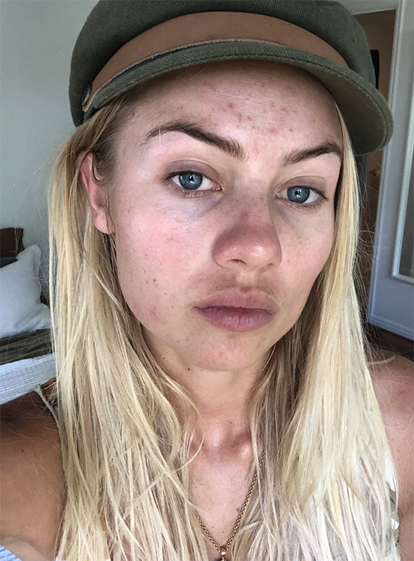 Elyse Knowles Skin Update May 2019 3.png