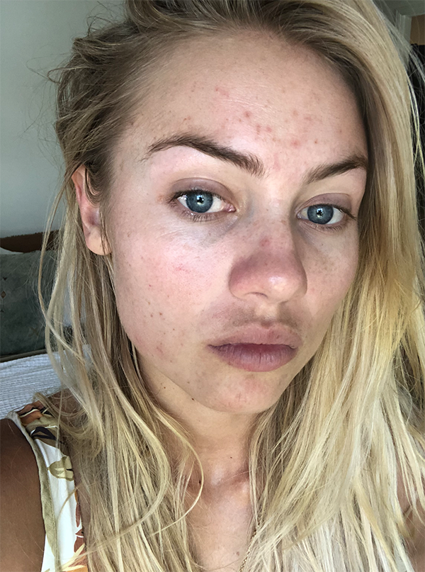 Elyse Knowles Skin Update May 2019 5.png