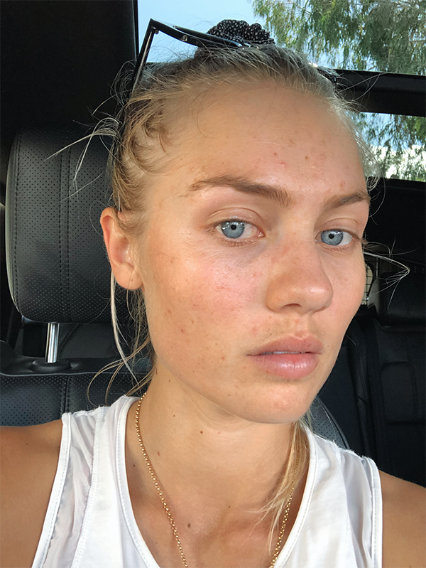 ELYSE KNOWLES SKIN UPATE 2019 3.PNG