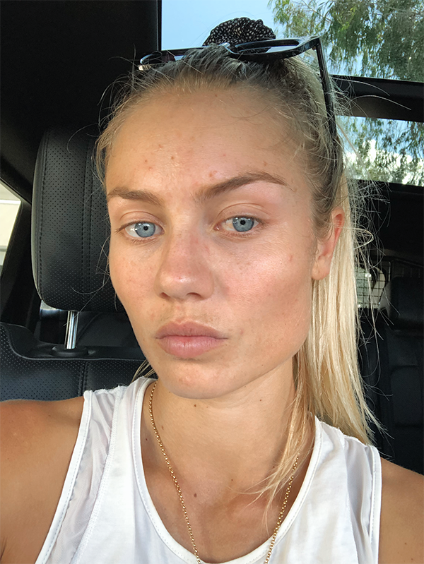 ELYSE KNOWLES SKIN UPATE 2019 4.PNG