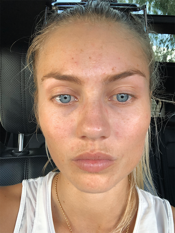 ELYSE KNOWLES SKIN UPATE 2019 5.PNG