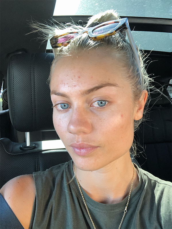 ELYSE KNOWLES SKIN UPATE 2019 10.png