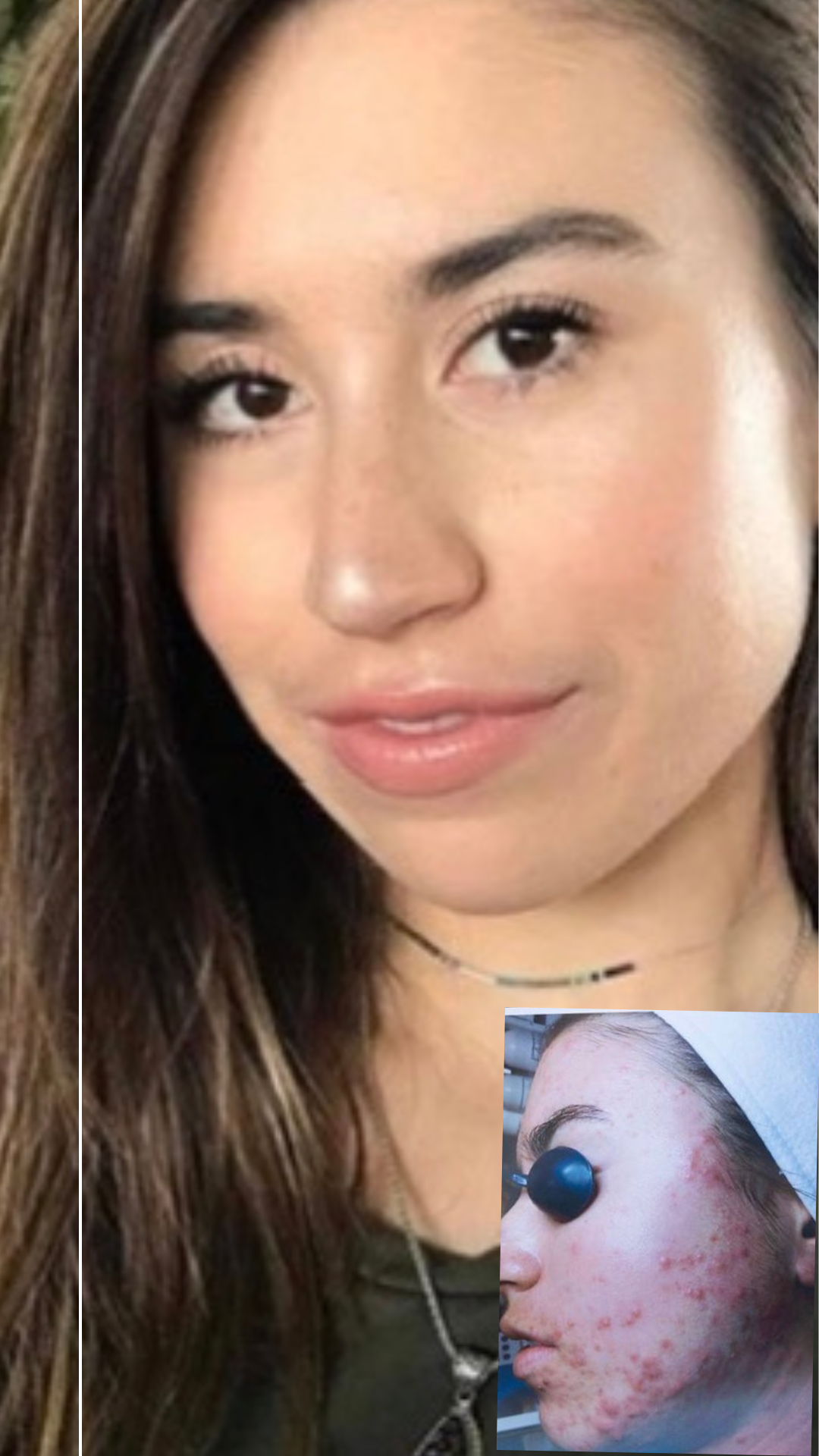 Get Clear Bosie 395.png