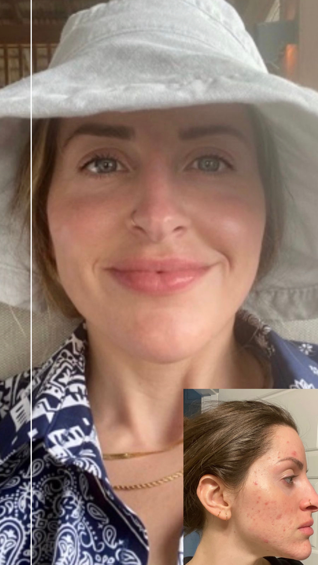 Get Clear Boise Before and After 839.png