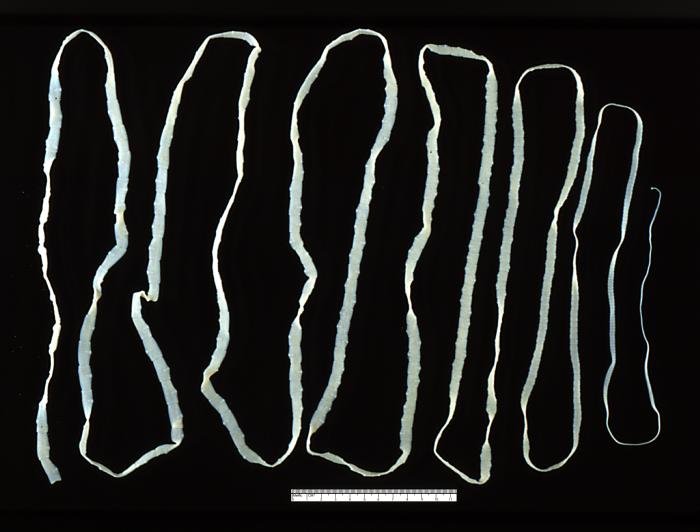 Taenia_saginata_adult_5260_lores.jpg