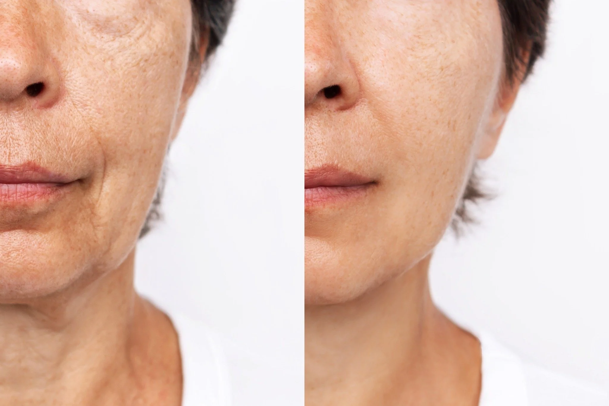 procell anti-aging B&A best.jpeg