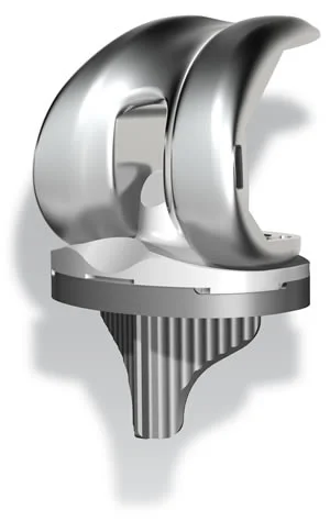 Total Knee Replacement Recovery: Three Keys to Post-Op Success