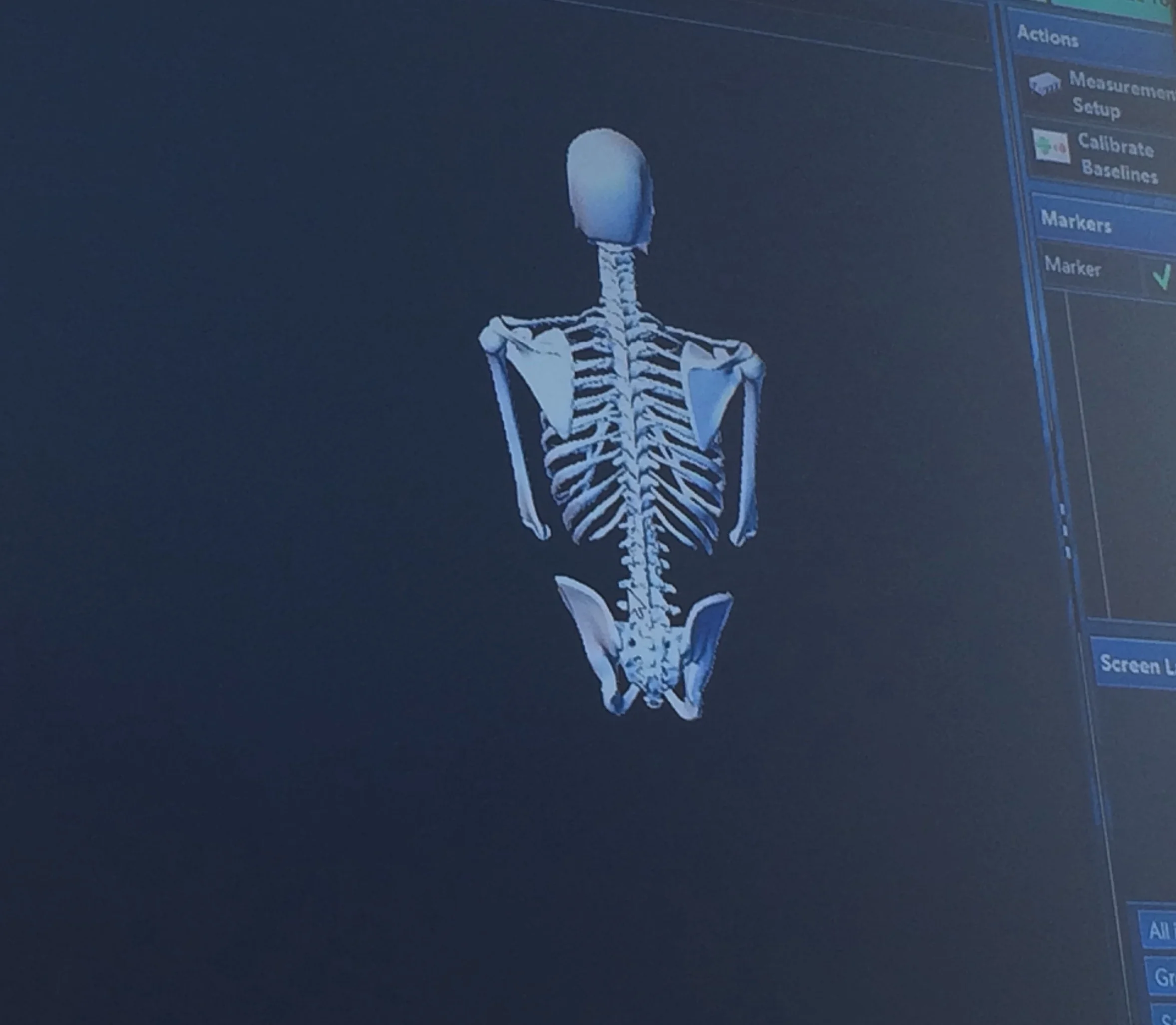 Physical Therapy for Shoulder Damage