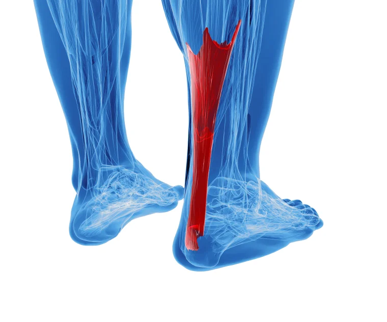 Achilles Tendon Physical Therapy