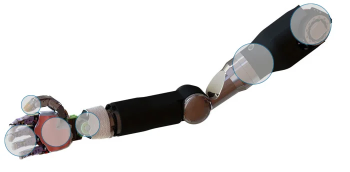 Upper Limb Amputation: Physical Therapy for Peak Performance