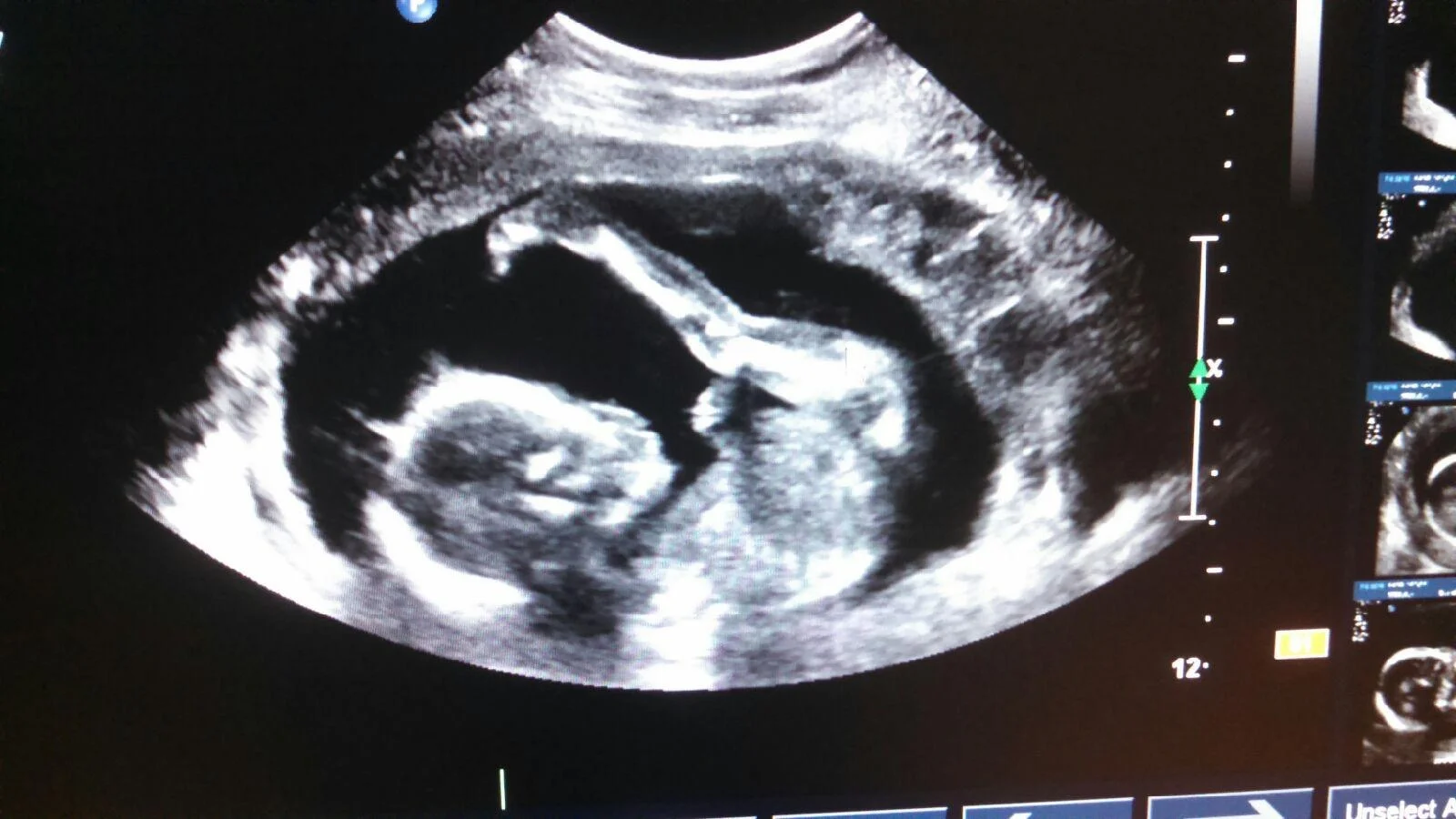 Look at those long legs. She's going to be a tall one, just like the rest of us.