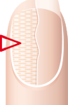 Nail description, properties and causes of nail damage | Mavala Switzerland