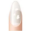 WHITE OR WHITE SPOTTED NAIL?