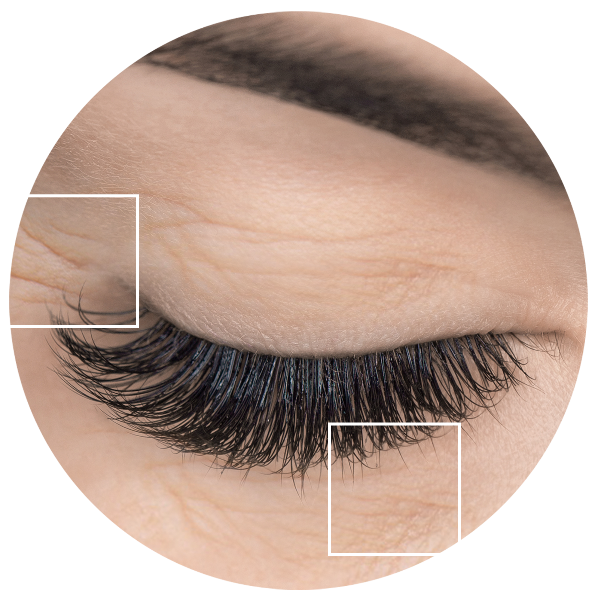 APPEARANCE OF WRINKLES AROUND THE EYES?