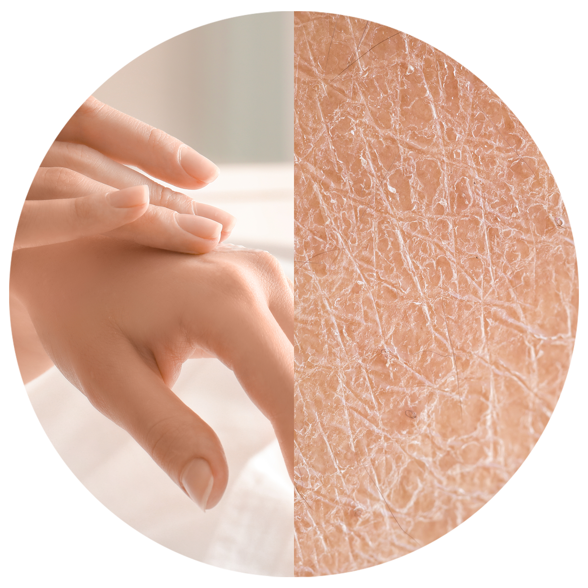 HANDS THAT ARE VERY DRY, DAMAGED?