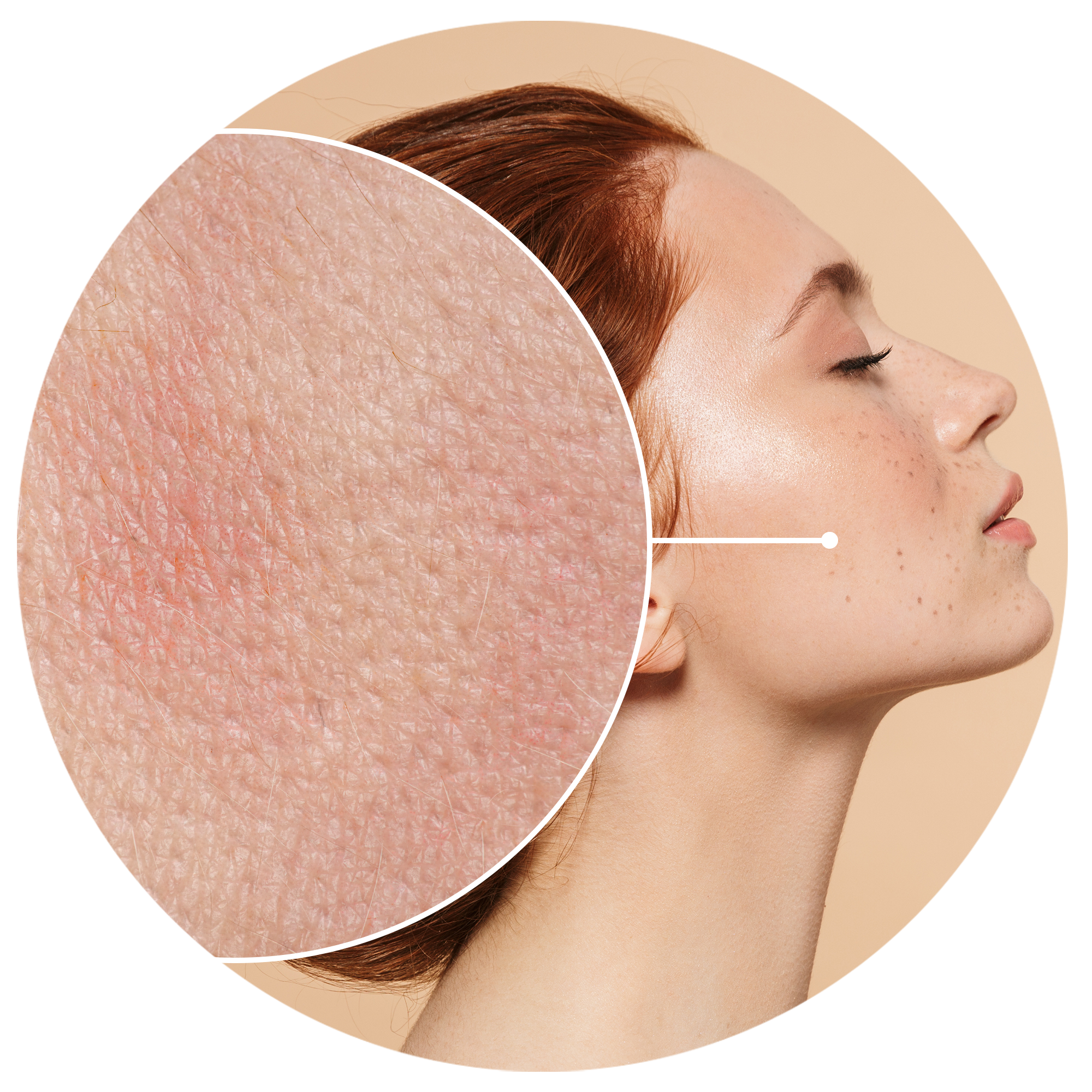 COMPLEXION WITH IRREGULARITIES?