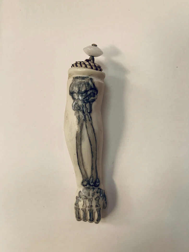 Traverso_skeleton ARM.jpg