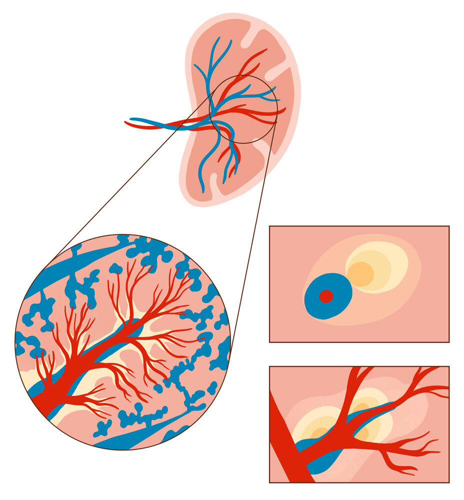 Lymphoid tissues in the spleen
