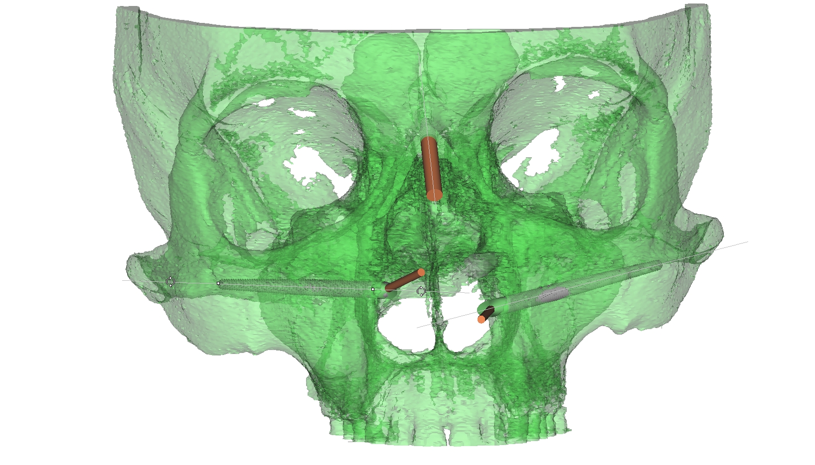 campbell alexander scott mr 3d1.jpg