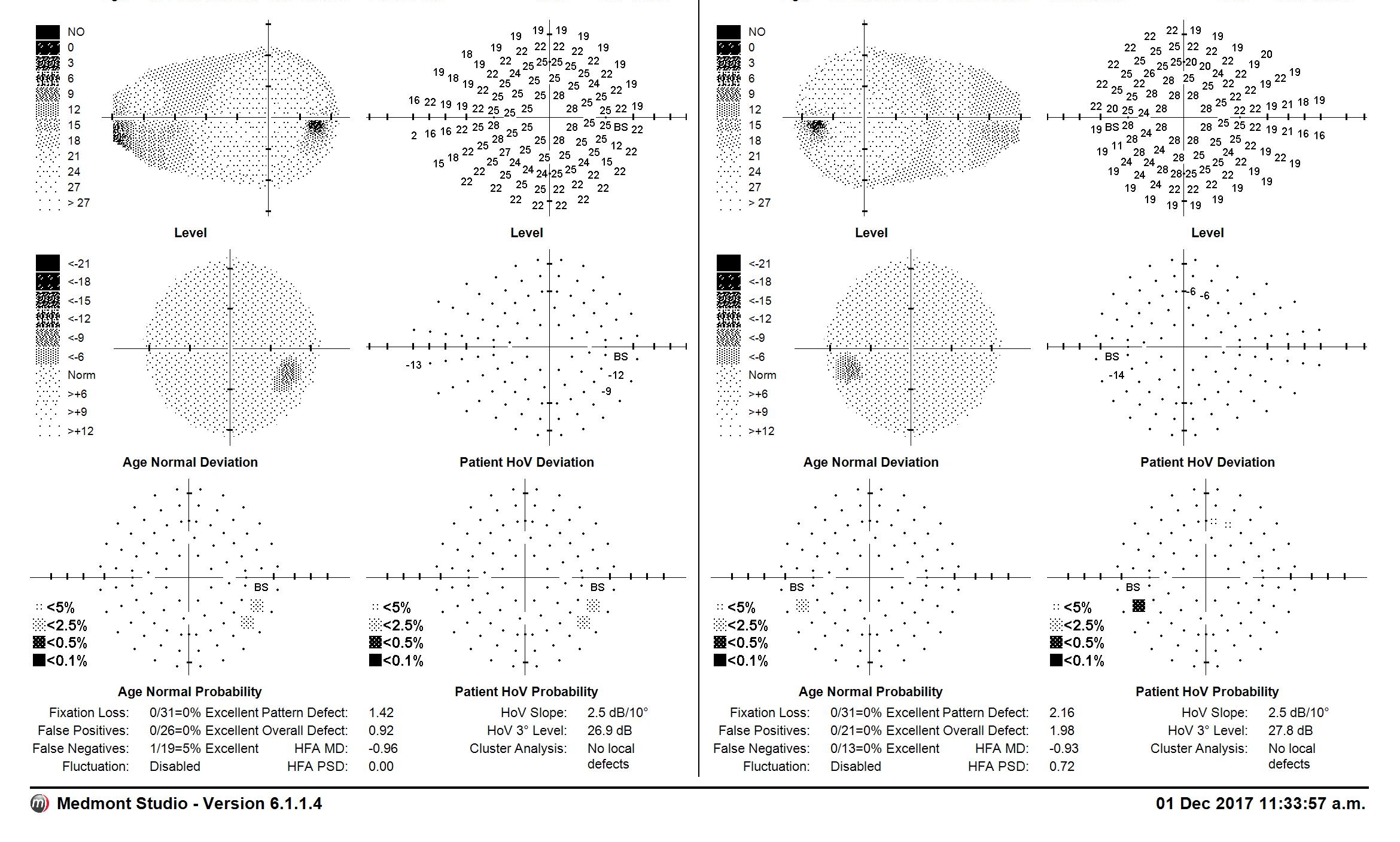 Medmont Visual Field Results