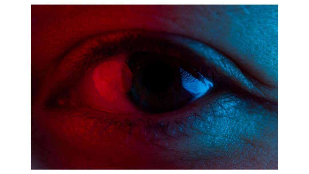 McDonald Adams Optometrists Red Light Helps Aging Eyes