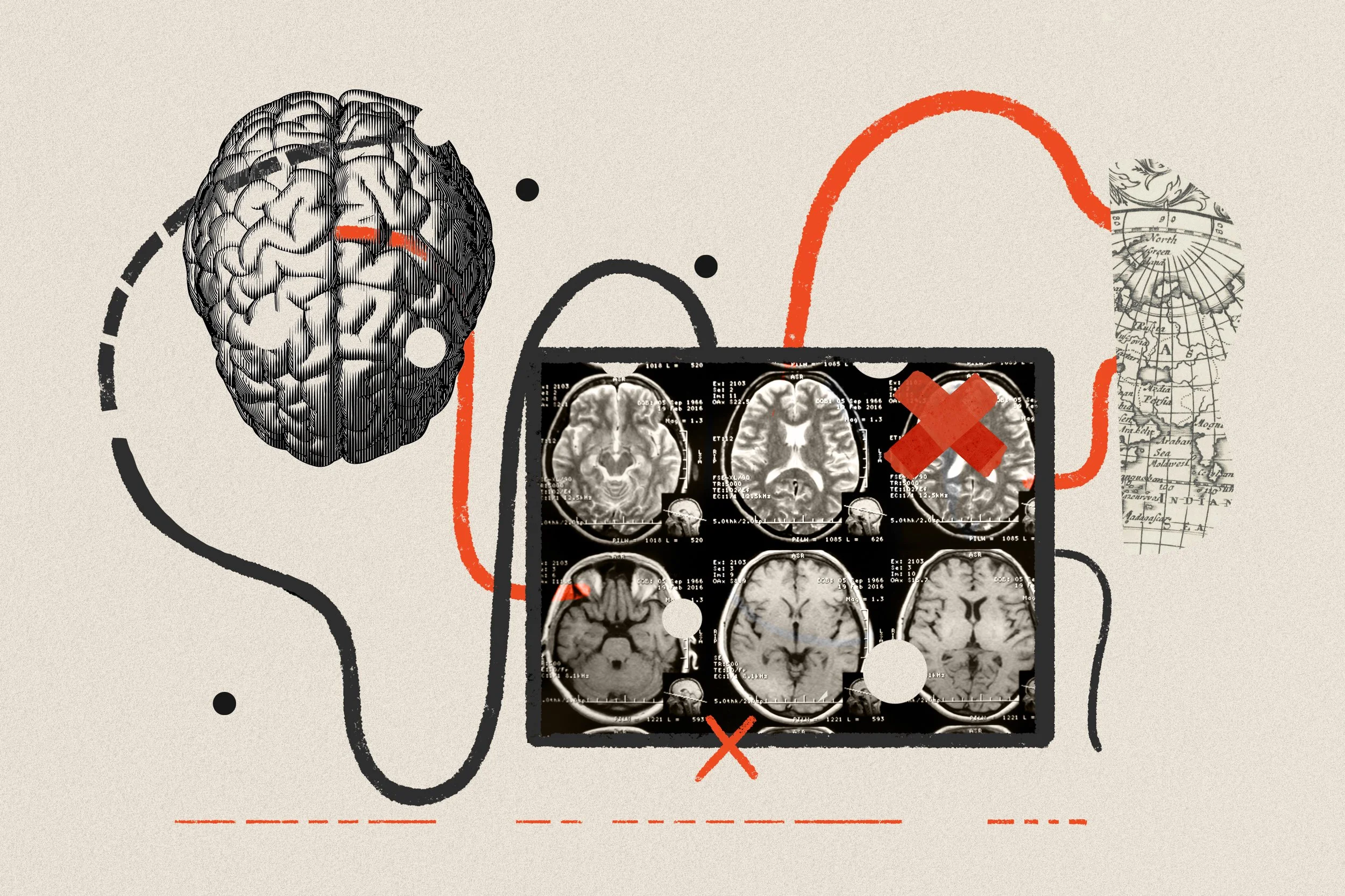 The Transmitter - BRAIN Initiative researchers ‘dream big’ amid shifts in leadership, funding