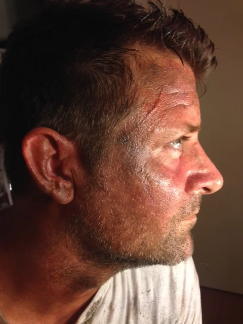 Dirt, Sweat, Scars, Redness